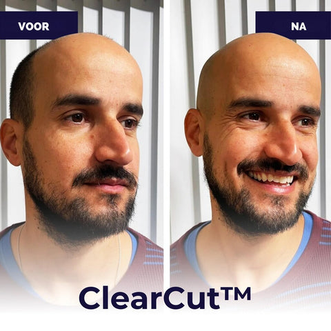 ClearCut® Moeiteloos Scheren: Het Ultieme Scheerapparaat!